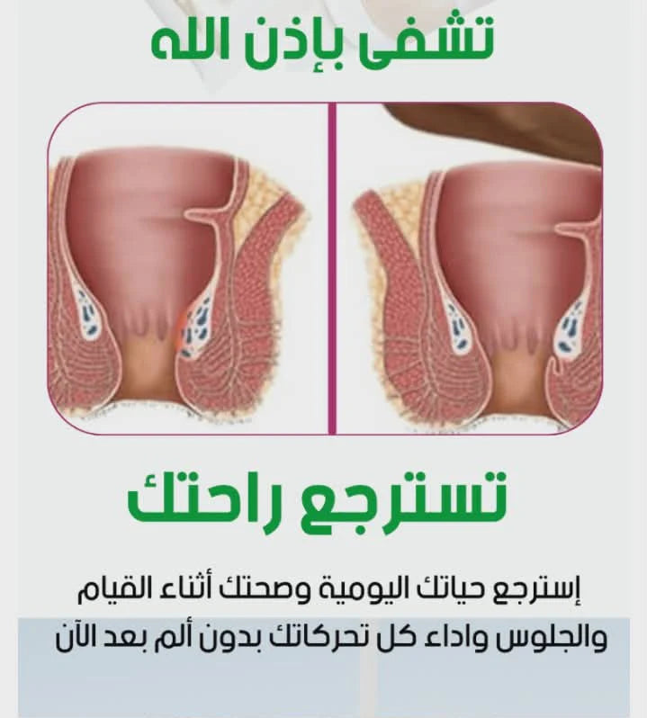 مرهم البواسير الاصلي ديكتامني